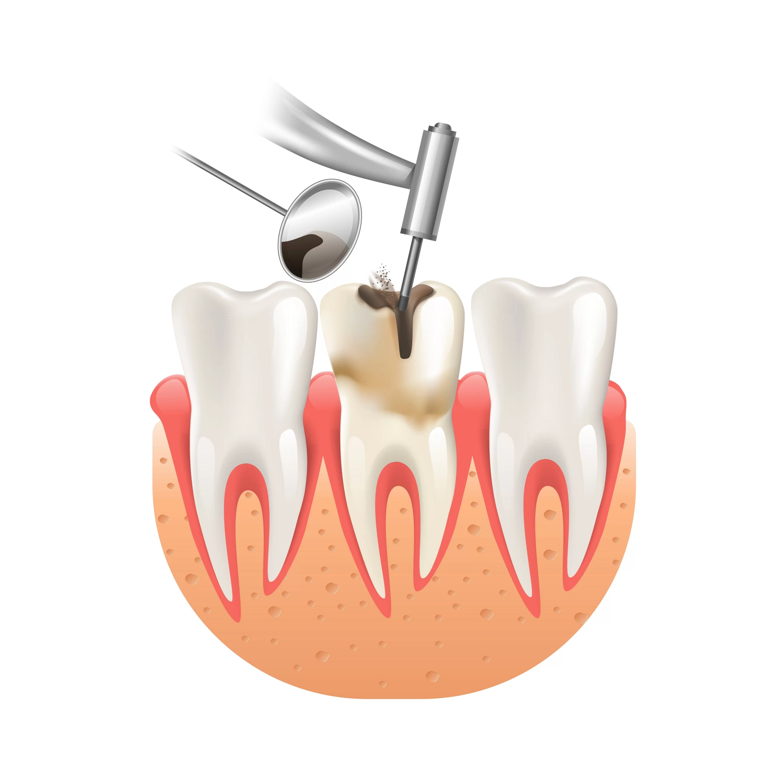 Endodonti: dişin pulpa ve kök kanal yapısı