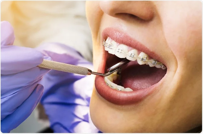 Diş kliniğinde dijital görüntüleme ve tedavi donanımı