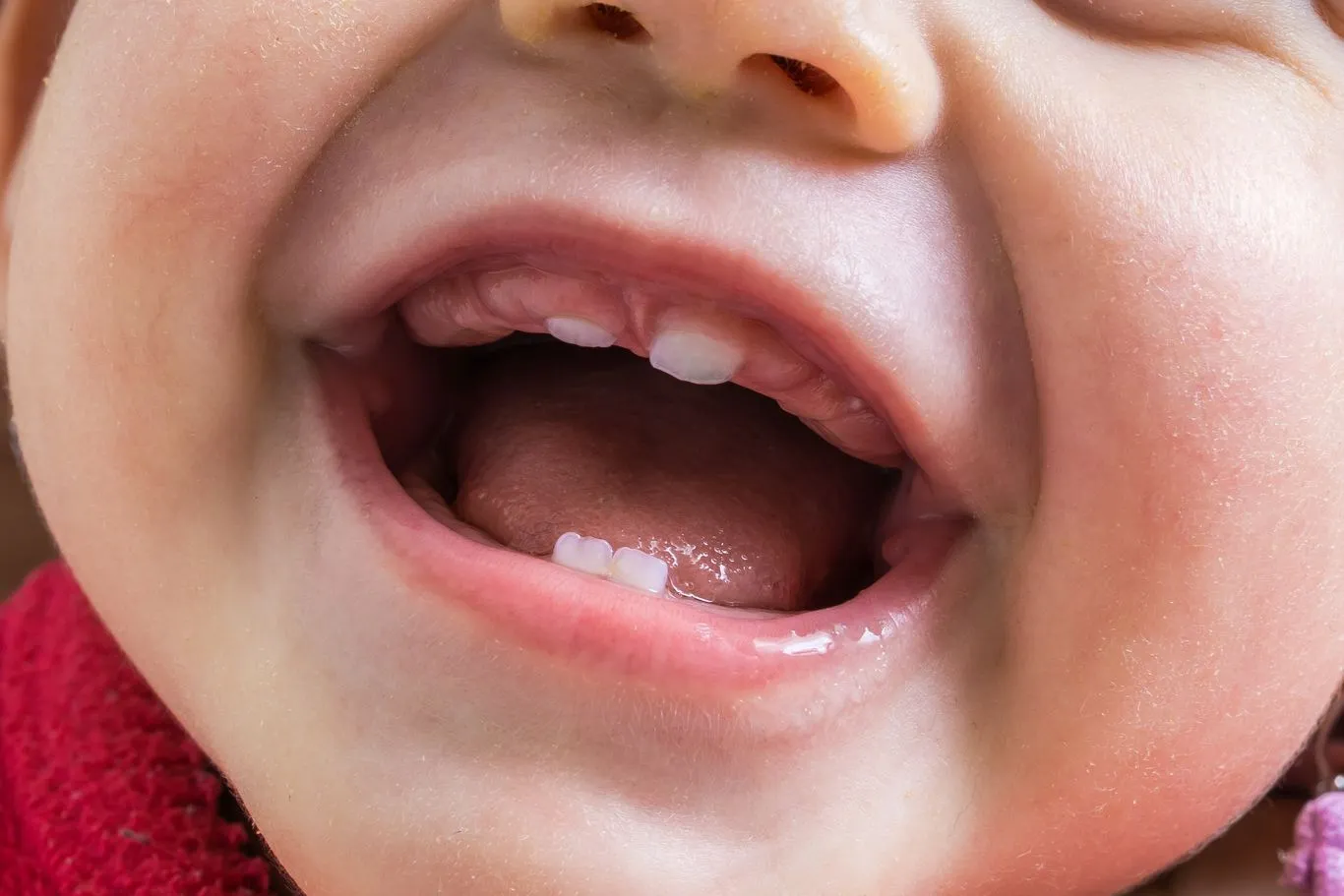 İlk süt dişleri çıkan gülümseyen bebek