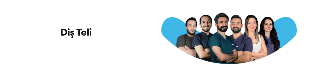 Diş Teli Nedir? Çeşitleri ve Nasıl Takılır?